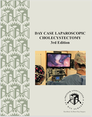 Day Case Laparoscopic Cholecystectomy 3rd Edition Cover